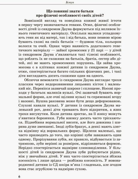 КЕНГУРУ Інклюзивне навчання за нозологіями. Дитина із синдромом Дауна 24873 фото